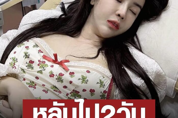 ออฟฟี่ แม็กซิม หลับไป 2 วัน พอฟื้นไปตรวจที่ รพ. พบเลือดออกในสมอง