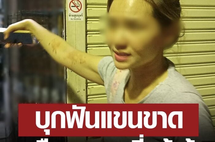 เตือนห้ามสูบบุหรี่! ไอ้โหดบุกร้านฟันแขนขาด ระทึกวิ่งไล่สาวหิ้วแขนแฟนหนุ่มไปรพ.