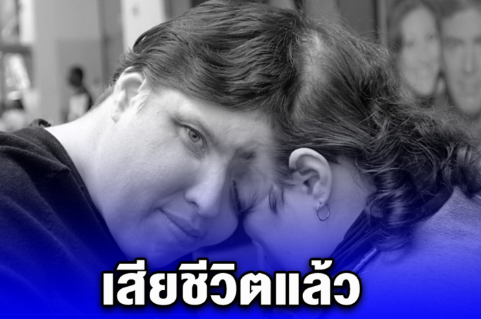 แฝดศีรษะติดกัน ลอรี-จอร์จ แชปเพลล์ เสียชีวิตแล้วในวัย 62 ปี