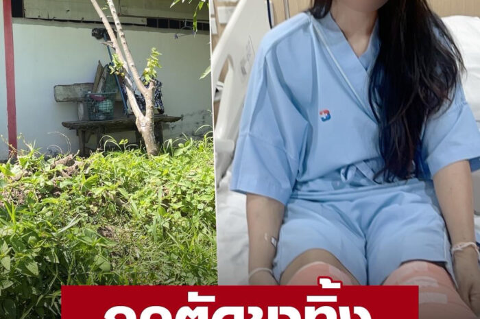 รันทดใจ! สาวร้องเกิดอุบัติเหตุ ถูกตัดขา 2 ข้าง แต่ประกันชีวิตไม่จ่าย อ้างทำเจ้าอื่นไว้ด้วย