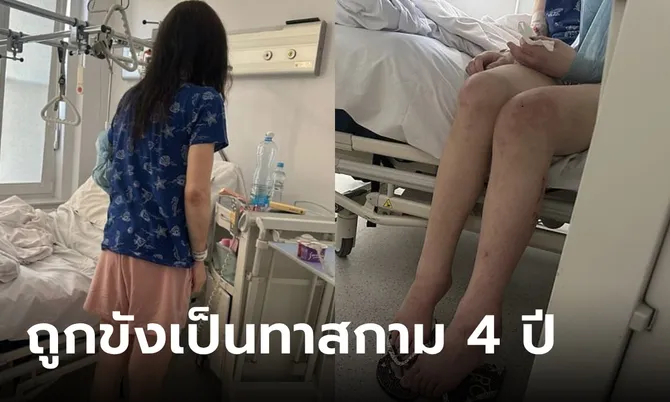 สาวถูก “คู่เดต” ขังเป็นทาสกาม 4 ปี ข่มขืนจนท้อง ทำร้ายทารุณฟันร่วง-ริมฝีปากหาย