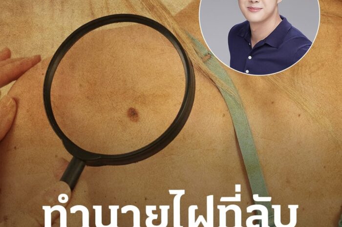 ไฝในที่ลับผู้หญิง ไฝในที่ลับผู้ชาย ดูดวงไฝในร่มผ้า เป็นไฝกินผัวจริงไหม?